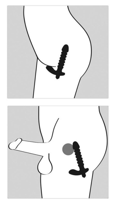 Plug/prostata-Black Velvets Vibrat Black Velvets